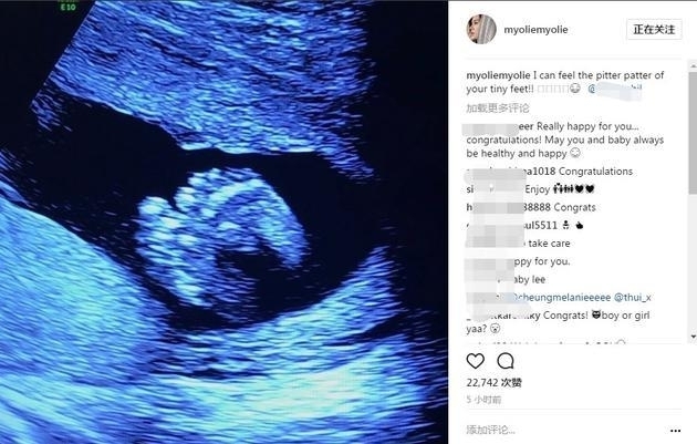胡杏儿开心即将当妈 微博晒超声波婴儿小脚丫(图)