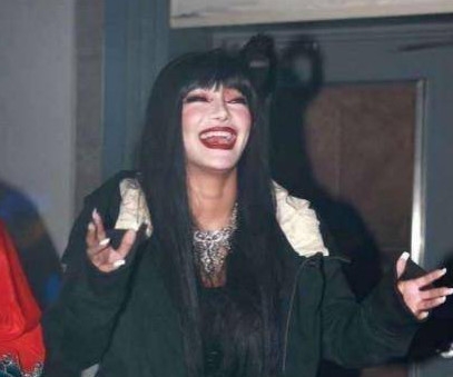 超女江映蓉近照曝光 这也太吓人了吧